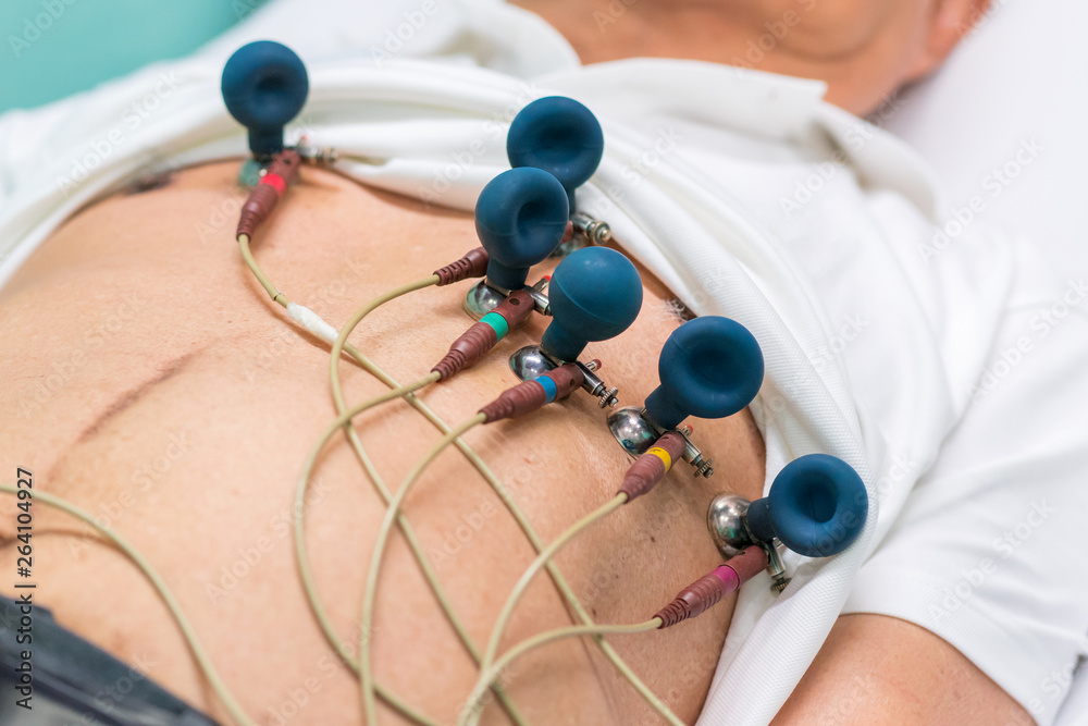 ECG or EKG Legs of man with electrodes for electrocardiogram records on