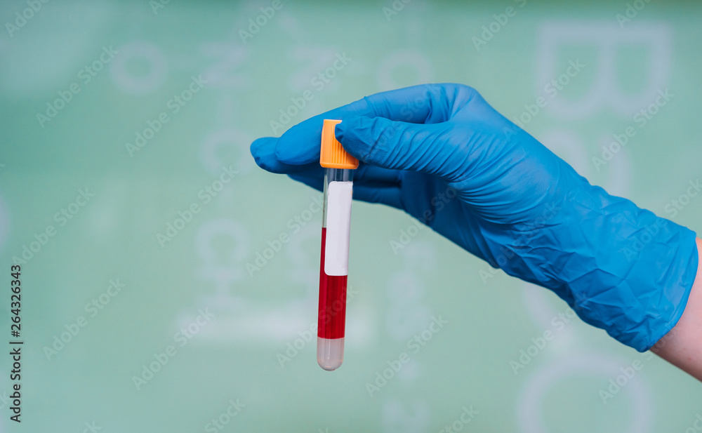 A rubber-gloved hand holds one test tube with the drug A rubber-gloved hand holds one test tube with the drug
