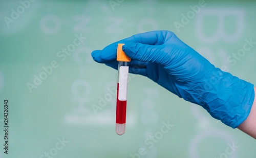 A rubber-gloved hand holds one test tube with the drug