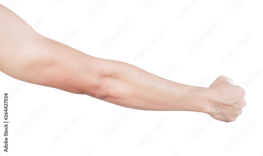Man arm with blood veins on white background, health care and medical concept Man arm with blood veins on white background, health care and medical concept