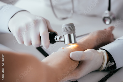 cropped view of dermatologist examining hand of woman while holding dermatoscope