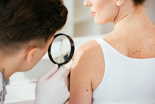cropped view of dermatologist holding magnifying glass while examining patient with skin disease photo