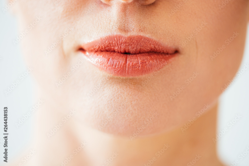 Obraz premium cropped view of herpes on lips of woman isolated on white