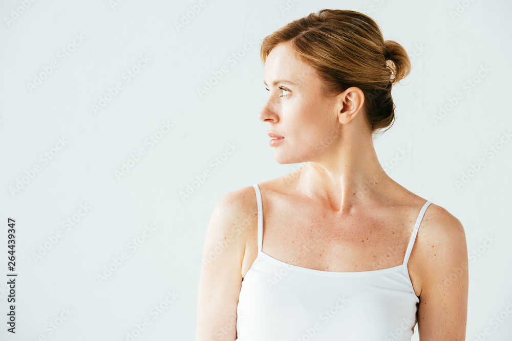 attractive woman with melanoma standing isolated on white attractive woman with melanoma standing isolated on white