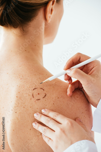 cropped view of dermatologist applying marks on skin of naked woman with pencil isolated on white