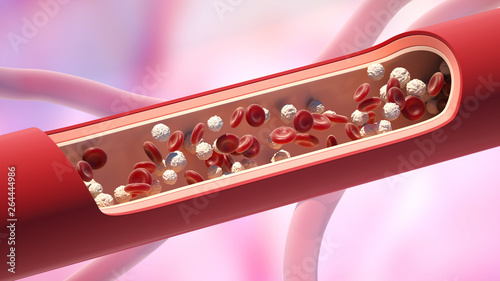 Tableau sur toile Red and white blood cells in the vein. Leukocyte high level