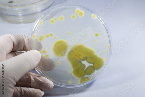 Colonies of Penicillium fungi grown on Sabouraud Dextrose Agar, photo showing yellow reverse side. Penicillium is a mold fungus that causes food spoilage