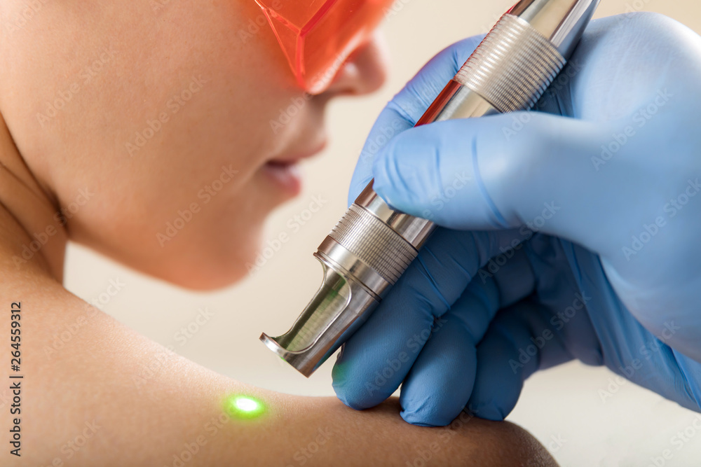 The girl on a session laser therapy.