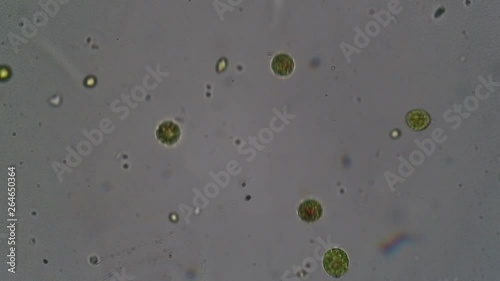 microscopic green algae in a laboratory sample taken from the water of a pond