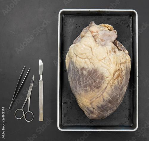 Cow Heart Dissection