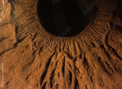 close-up images of human eye, iris and cornea from slit lamp biomicroscope for eye diagnosis.