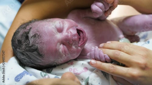 New Born Boy On Mothers Chest While Mom And Dad Hold Hands And Doc Checks Heart