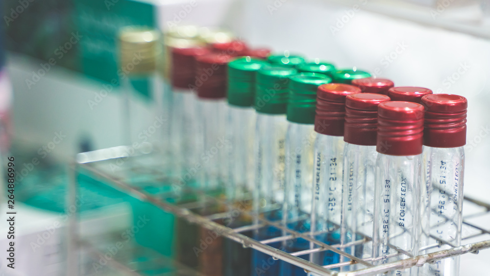 Test Tube Set With Caps and Rack Test Tube Set With Caps and Rack