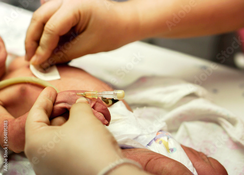The nurse hands is stabbed injection plug at sick newborn baby's hand to prepare fill the saline solution and medicine.