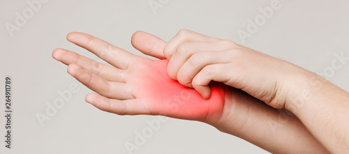 Woman scratching her itchy palm with rash
