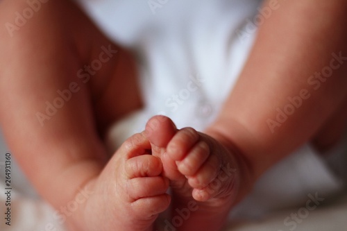 feet of a newborn baby boy without socks clubfoot hip dysplasia photo