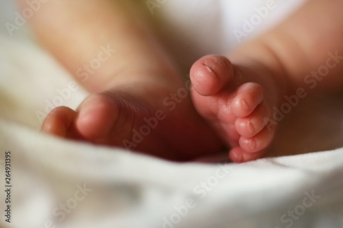 feet of a newborn baby boy without socks clubfoot hip dysplasia photo