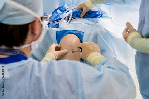 Arthroscope surgery. Orthopedic surgeons in teamwork in the operating room with modern arthroscopic tools. Knee surgery.