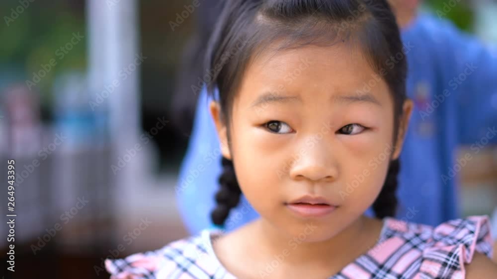 Asian girl are sick with conjunctivitis swollen eyes Asian girl are sick with conjunctivitis swollen eyes