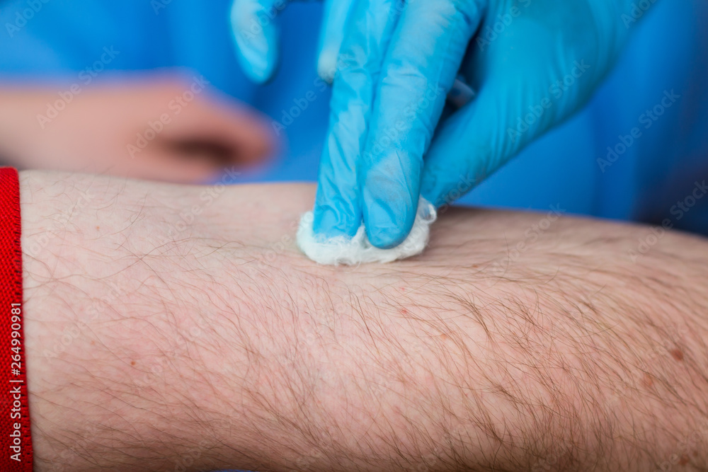the doctor preparing the hand of a man to place the catheter the doctor preparing the hand of a man to place the catheter