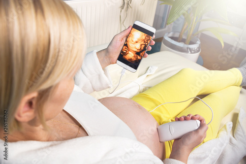 Modern pregnant woman sitting on a white couch at home relaxing and doing by herself digital 3D ultrasound scan of a baby with a mobile smart phone