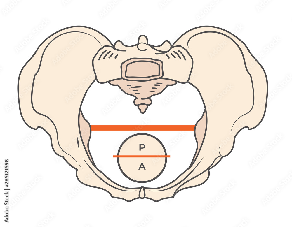Gynecoid Pelvis Shape with Round / Circular shape Gynecoid Pelvis Shape with Round / Circular shape
