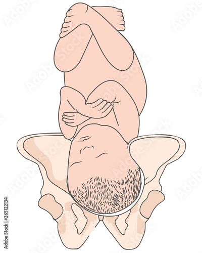 Left Occiput Posterior LOP Baby Fetal Position Pelvis  ROP Right photo