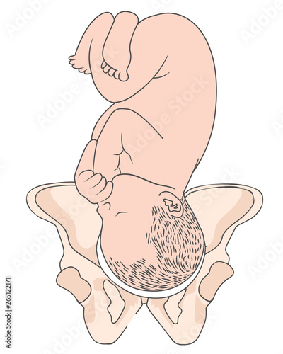 Left Occiput Transverse LOT Baby Fetal Position Pelvis ROT Right photo