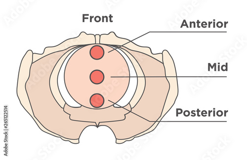 Pelvis medical illustration showing front, anterior, mid, & posterior photo