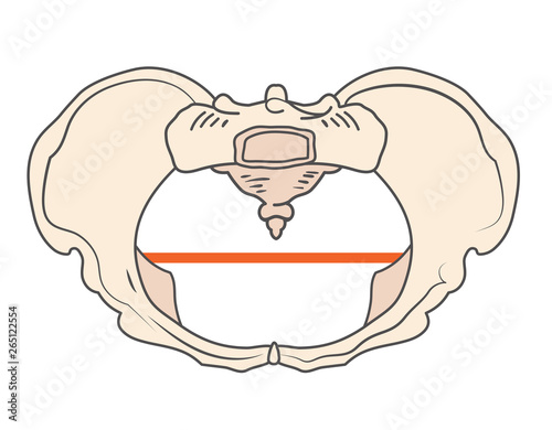 Platypoid or Platypelloid Pelvis Shape w Round or Circular shape