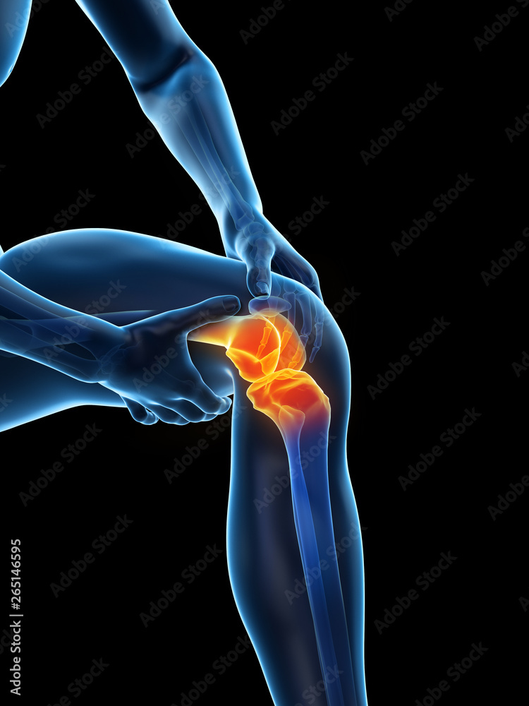 Obraz premium 3d rendered medically accurate illustration of a man having a painful knee