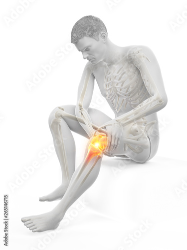 3d rendered medically accurate illustration of a man having a painful knee
