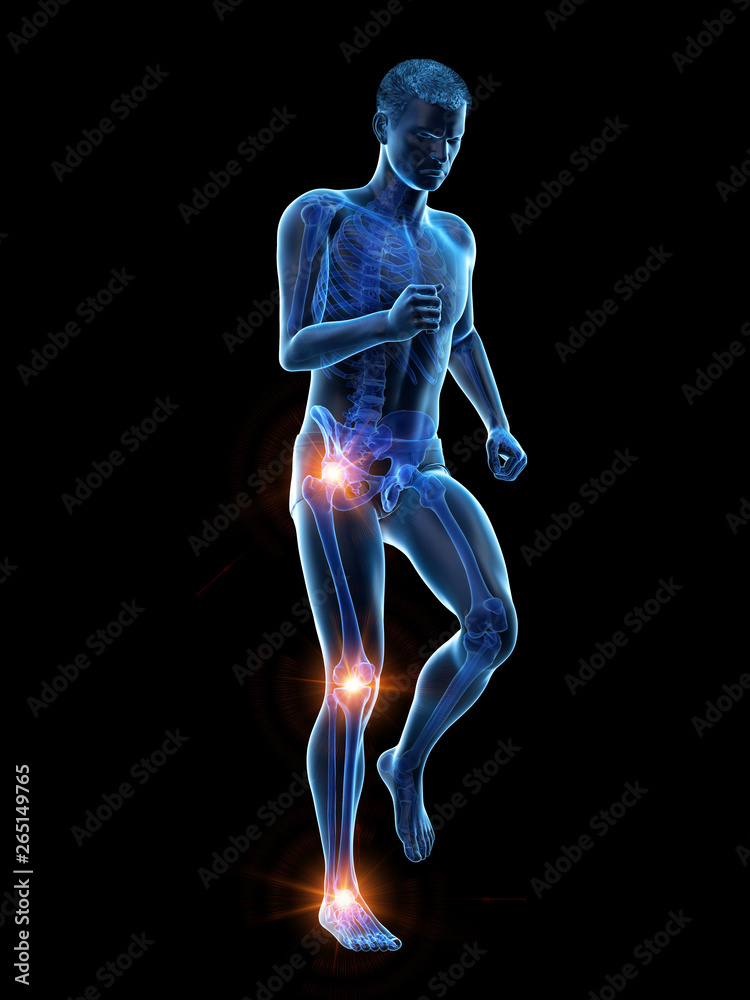 3d rendered medically accurate illustration of a walking man with painful jonts 3d rendered medically accurate illustration of a walking man with painful jonts