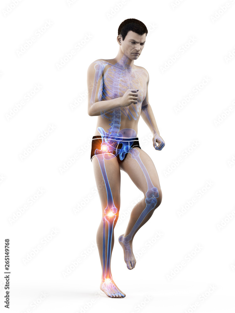 3d rendered medically accurate illustration of a walking man with painful jonts 3d rendered medically accurate illustration of a walking man with painful jonts