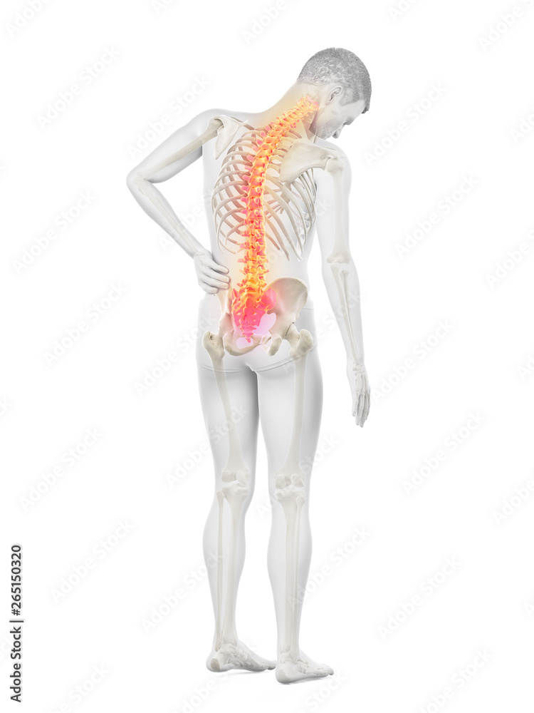 3d rendered medically accurate illustration of a man having backache