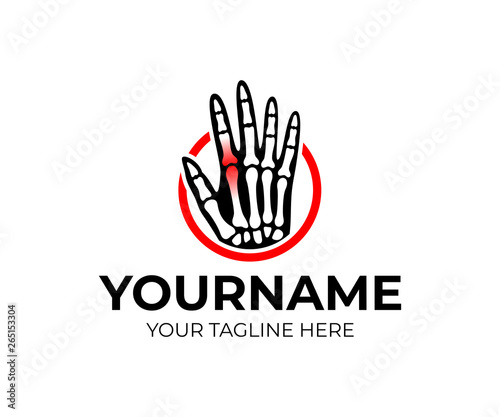 Hand with bones and a sore or inflamed joint in circle, logo design. Healthcare, medicine, rheumatology and traumatology, vector design and illustration