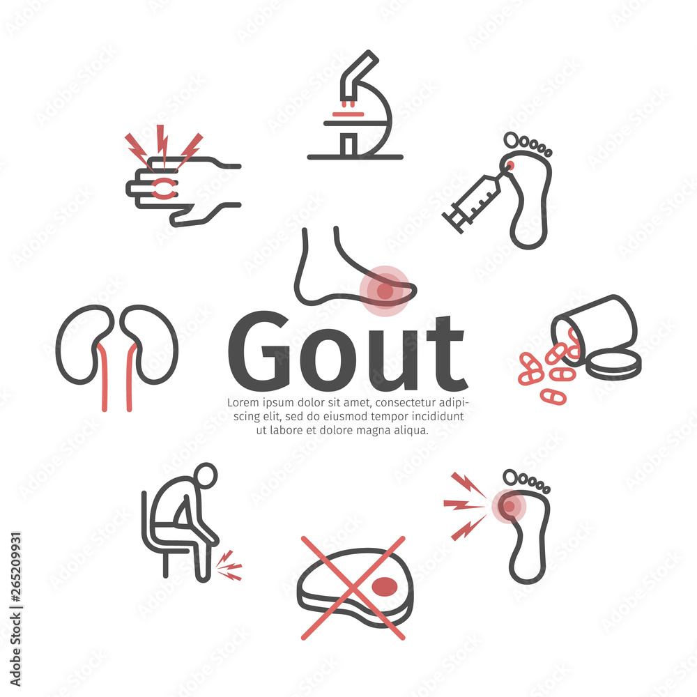 Gout banner. Symptoms, Treatment. Vector signs for web graphics.