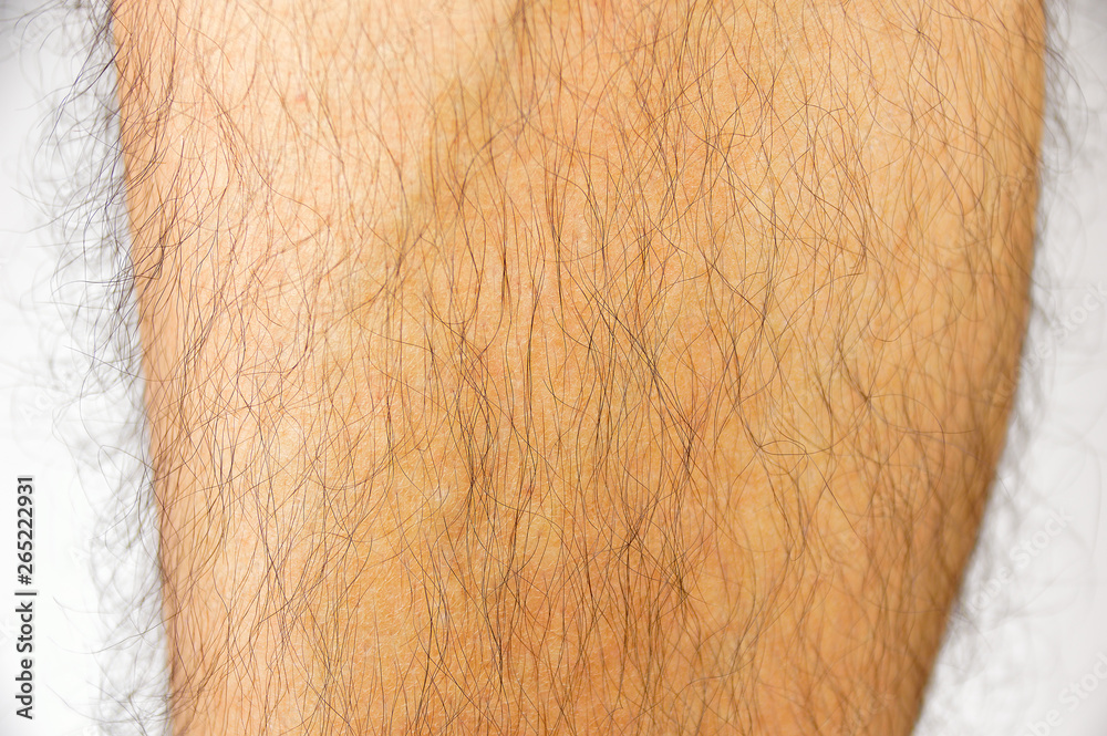 © cunaplus - closeup of hairy leg