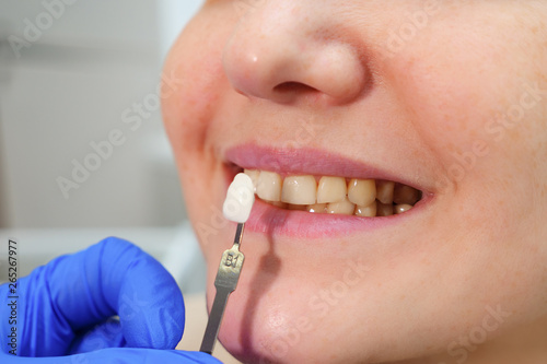 Dentist with tooth color samples is choosing shade for women patient teeth at dental clinic  close-up