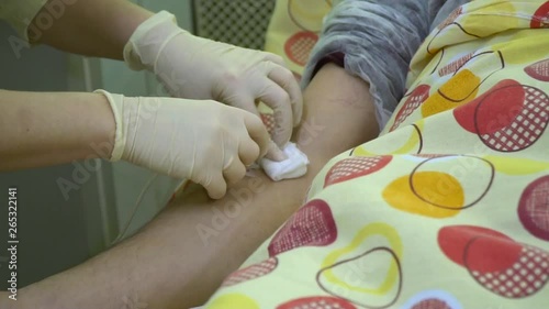 Plasmapheresis. Cleaning the patient’s blood through the device. A nurse removes a catheter from a patient's vein. Slow motion.