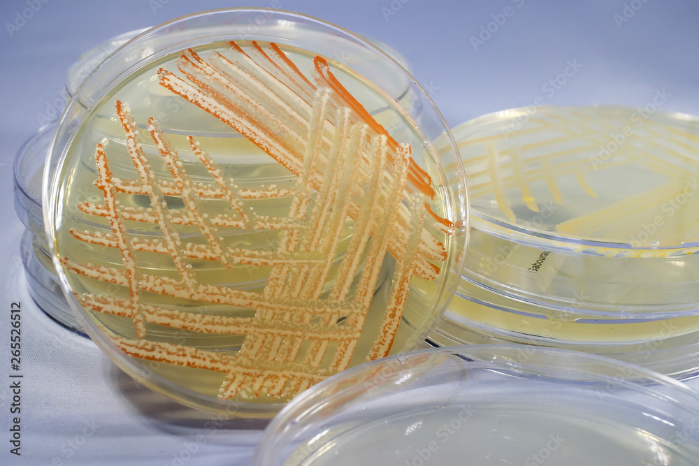 Mixed culture of bacteria of different colors grown on Petri dish with