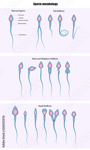 Sperm morphology, Vector diagram for your design, educational, science and medical