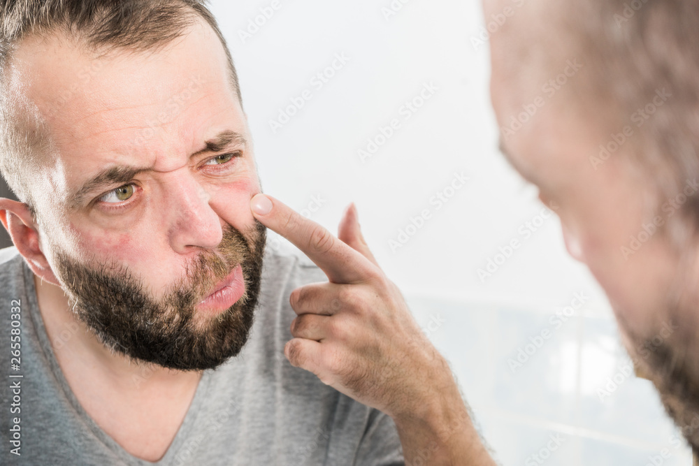 Obraz premium Man looking at wrinkles on his face