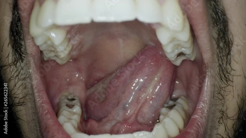 	man's throat from the inside close up