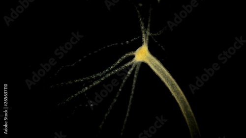 Hydra vulgaris under the microscope, a genus of freshwater sedentary intestinal cavity, biologically immortal organism, never grows old, is a predator, sets its tentacles and waits for prey photo