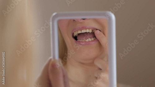Close-up of the face of an adult woman examining in the mirror missing tooth in the mouth.