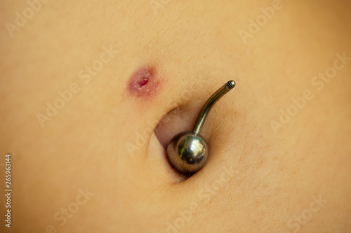 Belly piercing in the navel close up removal photo