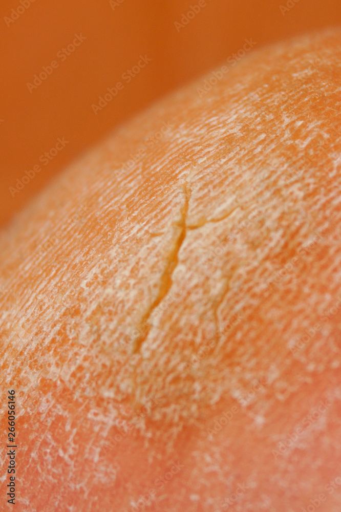 Fototapeta premium Closeup image of old callus with crack.