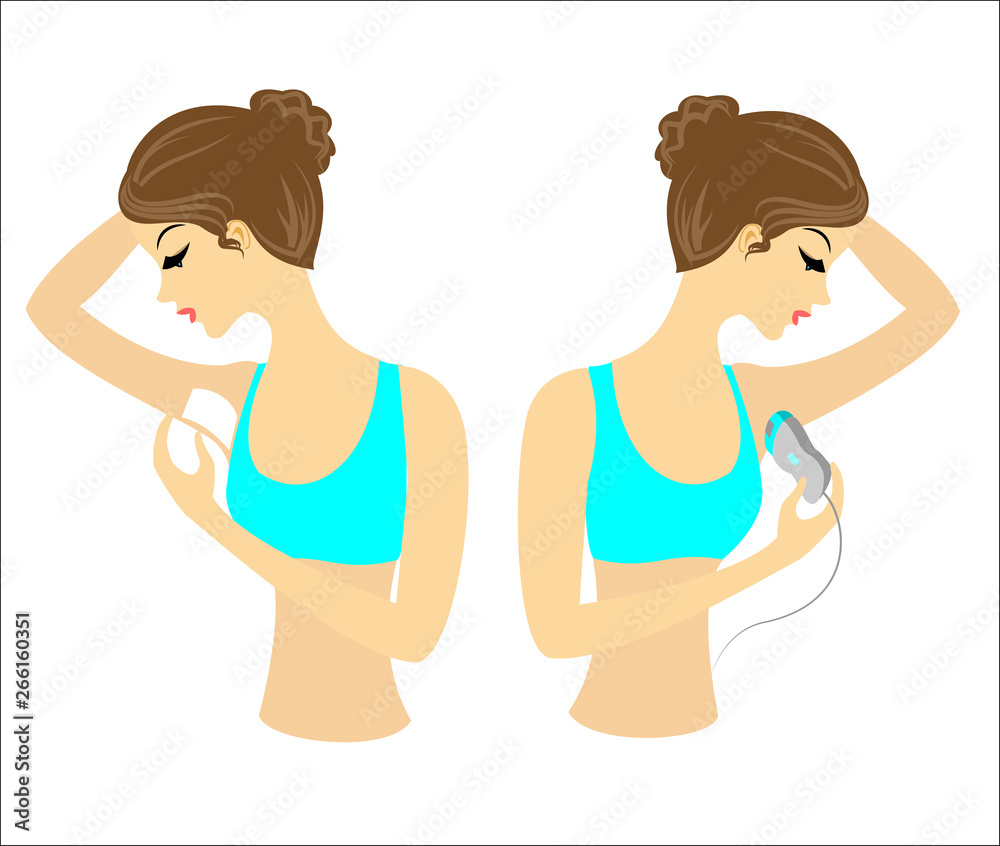 Profile of two girls. The ladies do the depilation of the underarms themselves. Remove the hair with a gel, wax and epilatory. Vector illustration Profile of two girls. The ladies do the depilation of the underarms themselves. Remove the hair with a gel, wax and epilatory. Vector illustration