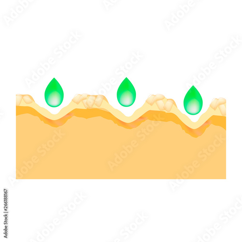 Inflamed acne on the skin. Inflamed pimple. Acne scar. Acid peeling treatment. Enlarged pores. The structure of the skin. Wrinkles. Infographics. Vector illustration on isolated background.